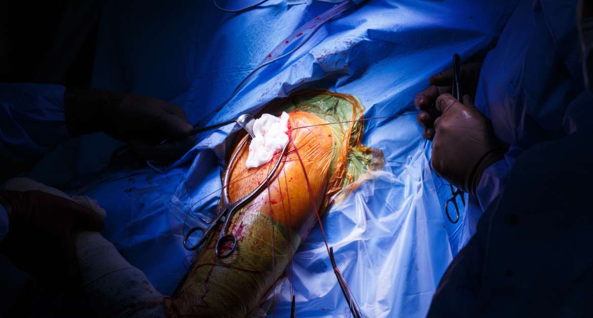 Offene und minimalinvasive Operationen an der Schulter
