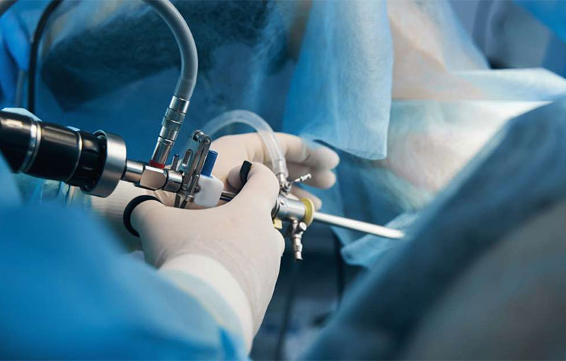 Arthroskopische Eingriffe am Ellenbogen in München - Durchgeführt von Prof. Dr. med. Martetschläger